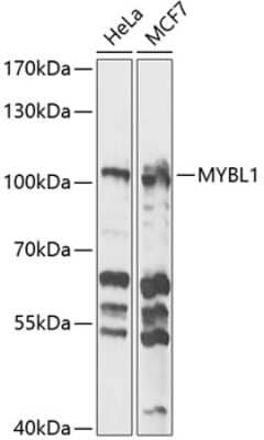 Western Blot: A-Myb Antibody [NBP2-92586] - Western blot analysis of extracts of various cell lines, using A-Myb antibody (NBP2-92586) at 1:1000 dilution. Secondary antibody: HRP Goat Anti-Rabbit IgG (H+L) at 1:10000 dilution. Lysates/proteins: 25ug per lane. Blocking buffer: 3% nonfat dry milk in TBST. Detection: ECL Basic Kit. Exposure time: 10s.